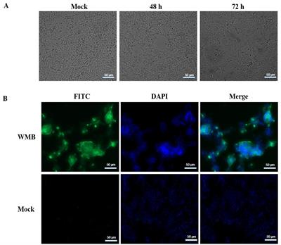 Isolation and characterization of porcine epidemic diarrhea virus with a novel continuous mutation in the S10 domain